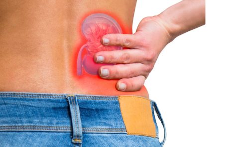 bobrek tasi holep uroloji doktoru kadir tepeler tas hastaliklari13