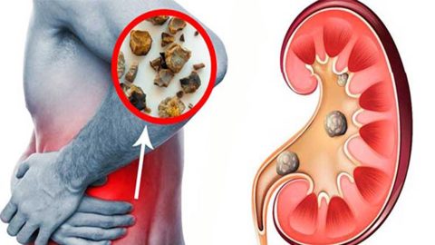 tas hastaliklari tedavisi